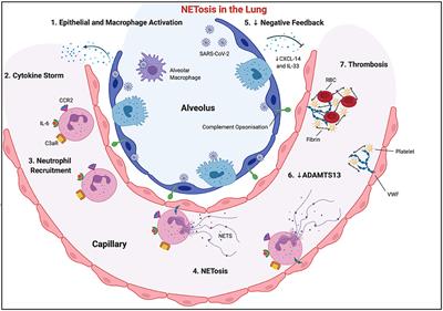 Immune System Disequilibrium—Neutrophils, Their Extracellular Traps, and COVID-19-Induced Sepsis